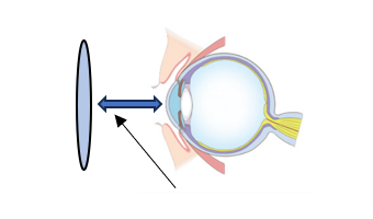 頂点間距離1.2㎝